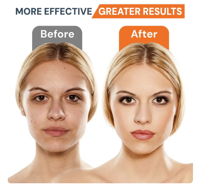 Last Day Promotion 49% OFF🔥Face & Neck Skin Lifting Machine