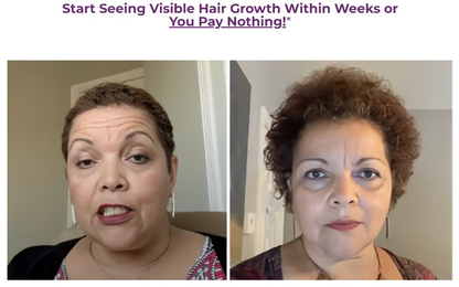 Allurium Hair Growth Serum™