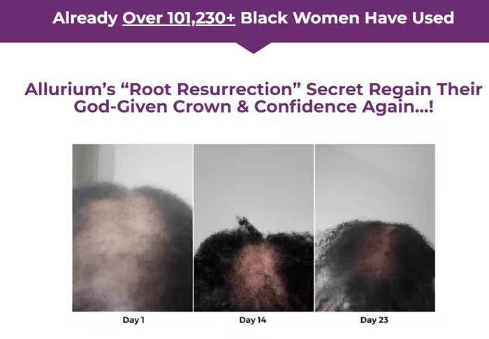 Allurium Hair Growth Serum™