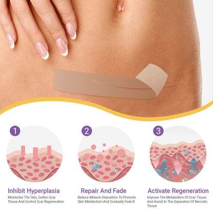 BBOJI® Hyaluronic Acid Nano-Microneedle Repair Tape🏥 (treats new and old scars, reduces surgical scars, stretch marks, keloids, acne, burns, warts, dermatomes and varicose veins)