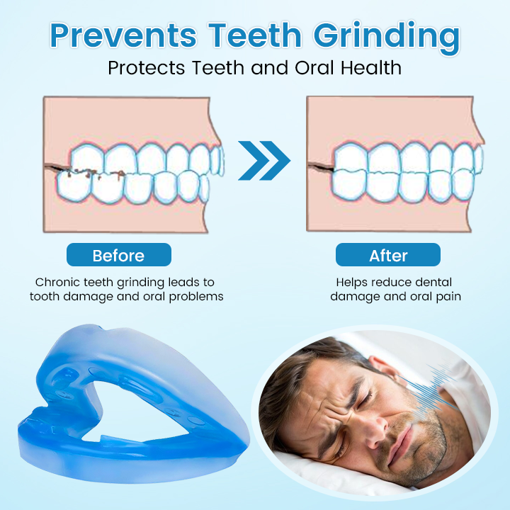 QIAWI™ DreamGuard:Anti-Snoring & TeethGrinding Mouthpiece
