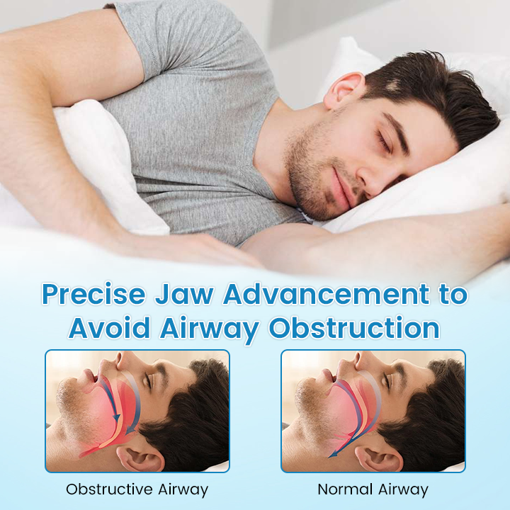 QIAWI™ DreamGuard:Anti-Snoring & TeethGrinding Mouthpiece