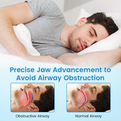 QIAWI™ DreamGuard:Anti-Snoring & TeethGrinding Mouthpiece
