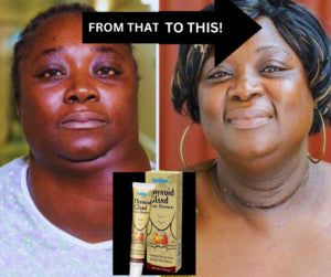 Sumiphen Thyroid Care Ointment | Topical ointment used to relieve goiter, sore throat, and pain from thyroid nodules.