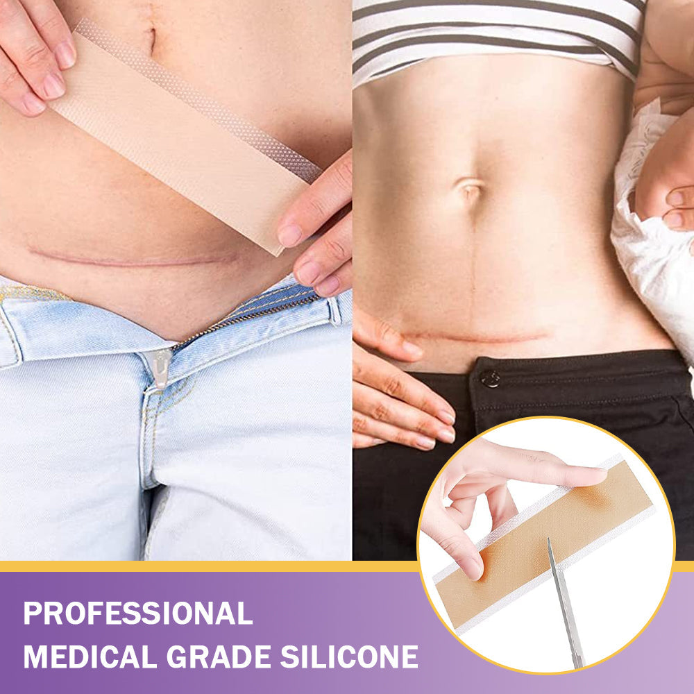 BBOJI® Hyaluronic Acid Nano-Microneedle Repair Tape🏥 (treats new and old scars, reduces surgical scars, stretch marks, keloids, acne, burns, warts, dermatomes and varicose veins)