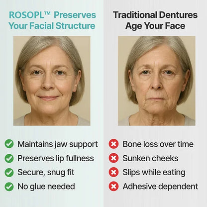 🌎Ends Today: 70% OFF! ROSOPL™ Custom-Fit Full Functional DenturesMake you more confident