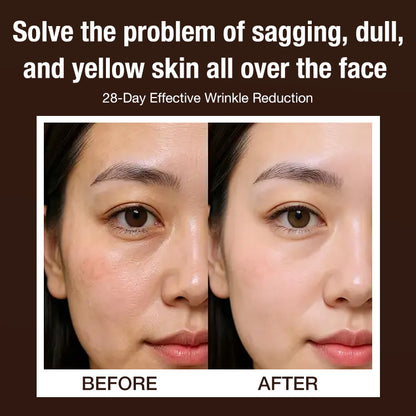 Lingzhi Anti-Wrinkle Revitalizing Essence - Reduces fine lines/Deep repair/Moisturizes and firms skin - Effectively reduces wrinkles in 28 days