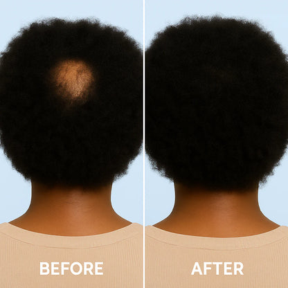 OrréNaturals™ Hair Revival Ampoule