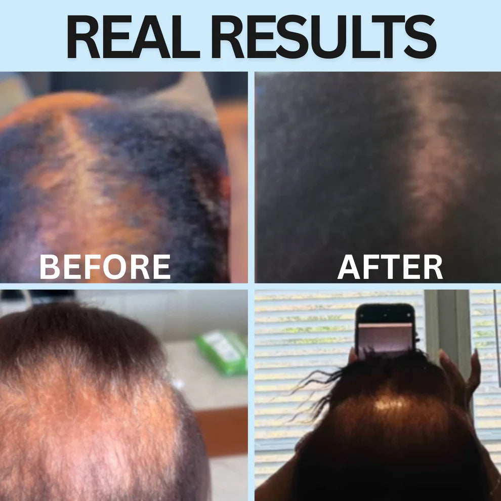 OrréNaturals™ Hair Revival Ampoule