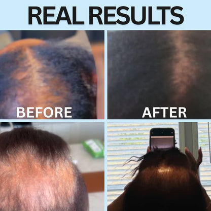 OrréNaturals™ Hair Revival Ampoule