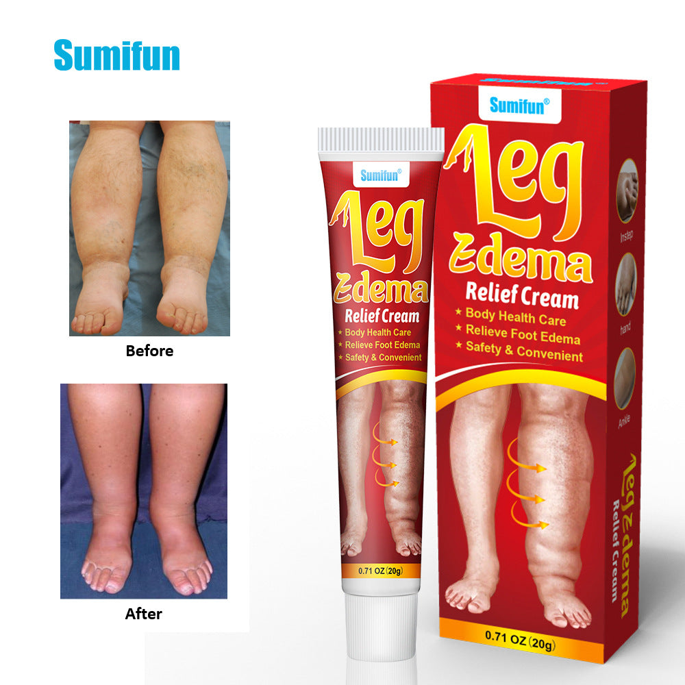 Swelling Cream - Relieves Swelling
