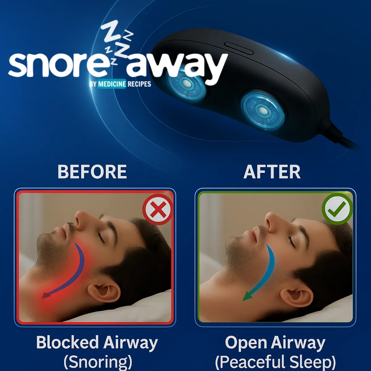 SnoreAway™ | Anti-Snoring Neurostimulation Device