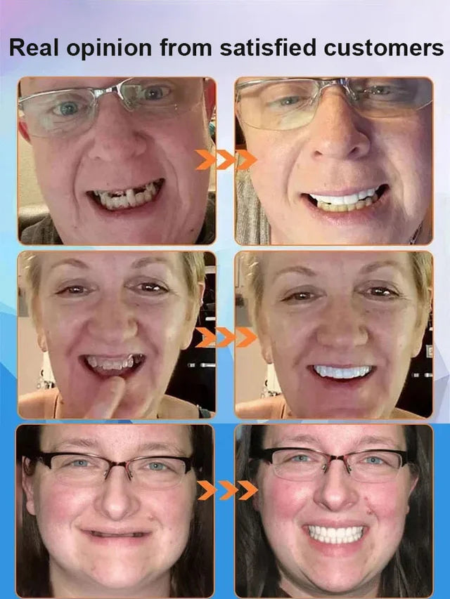 Silicone Simulation Teeth Braces