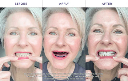 Hismile V34 Teeth Whitening Strips